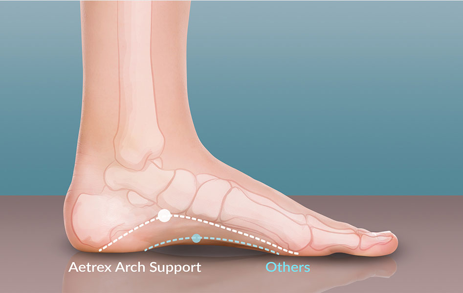 aetrex shoes for plantar fasciitis